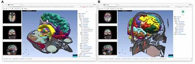 The Open Anatomy Browser: A Collaborative Web-Based Viewer for Interoperable Anatomy Atlases